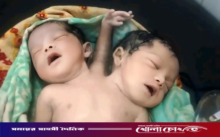 নওগাঁয় দুই মাথা ও তিন হাতওয়ালা শিশুর জন্ম, এক ঘণ্টার মধ্যেই মৃত্যুর হার