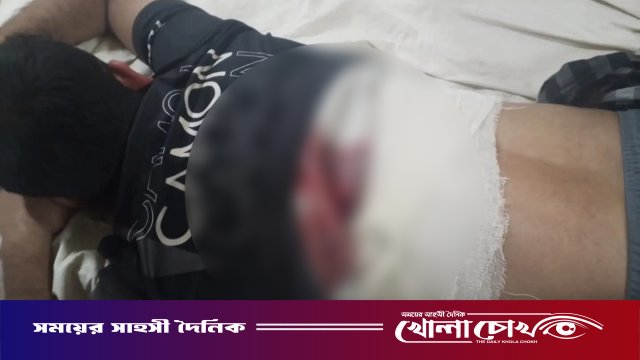 নোয়াখালীতে ব্যবসায়ীকে গুলি করে মোটরসাইকেল ছিনতাই