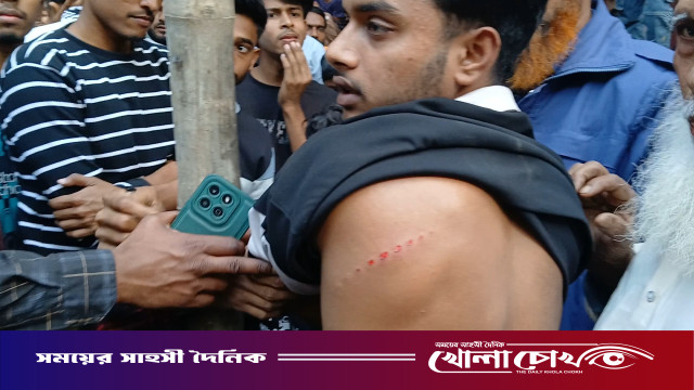 শ্রীনগরে পুর্ব শত্রুতার জেরে উভয় পক্ষের পাল্টাপাল্টি হামলায় আহত-৩