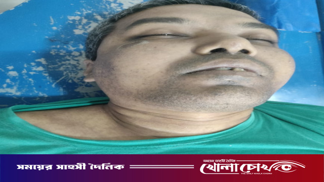 ফরিদপুরে কাপড় শুকানোর রশি টানানোকে কেন্দ্র করে সংঘর্ষে একজন নিহত