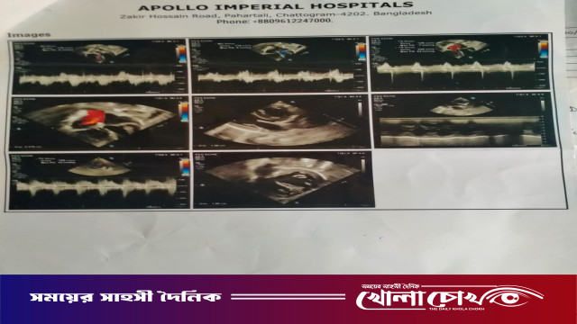 হার্টে ছিদ্র নিয়ে মৃত্যুর সাথে পাঞ্জা লড়ছে ১৮ মাসের শিশু মেশিংওয়াং মারমা