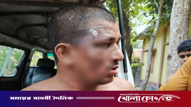 ফরিদপুরে বুদ্ধিপ্রতিবন্ধী যুবকের শরীরে ফুটন্ত গরম পানি ঢেলে ঝলসে দেওয়ার অভিযোগ