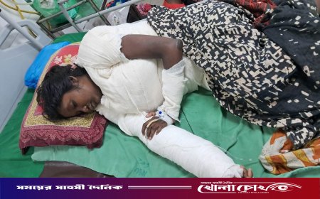 নগরকান্দায় চুলার আগুনে দগ্ধ কিশোরীর চিকিৎসাধীন অবস্থায় করুণ মৃত্যু