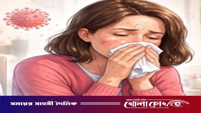 ফরিদপুরে ২৪ ঘণ্টায় ২৮টি নতুন হাম রোগী শনাক্ত, মোট আক্রান্ত ১৫২