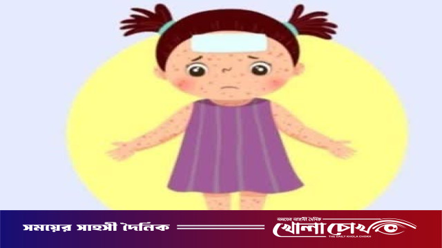 ফরিদপুর জেলার হামের সর্বশেষ আপডেট প্রকাশ করেছে  সিভিল সার্জন এর কার্যালয়