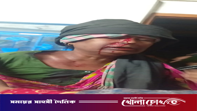 মায়ের ওপর সৎ সন্তানদের নির্মম হামলা, হাসপাতালে ভর্তি