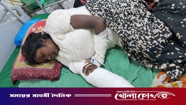 নগরকান্দায় চুলার আগুনে দগ্ধ কিশোরীর চিকিৎসাধীন অবস্থায় করুণ মৃত্যু