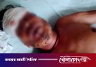 ফরিদপুরের সদরপুরে মাদক ব্যবসায়ীর তাণ্ডব: সৌদি প্রবাসীকে কুপিয়ে জখম, ৩ লাখ টাকা ও মোটরসাইকেল ছিনতাই