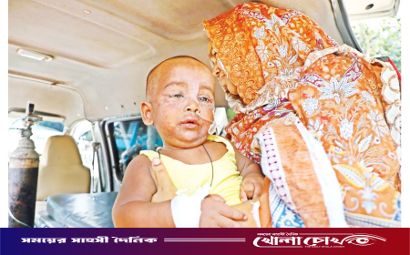 হামের সংক্রমণের মধ্যেই চোখ রাঙাচ্ছে ডিপথেরিয়া। ছড়িয়ে পড়ার শঙ্কা