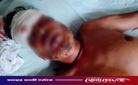 ফরিদপুরের সদরপুরে মাদক ব্যবসায়ীর তাণ্ডব: সৌদি প্রবাসীকে কুপিয়ে জখম, ৩ লাখ টাকা ও মোটরসাইকেল ছিনতাই