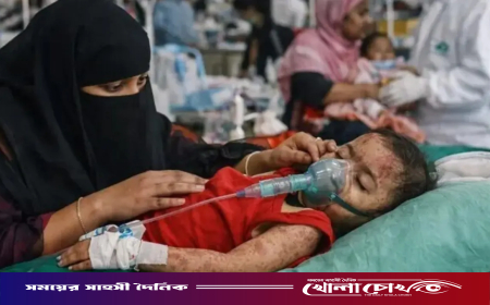 হামের উপসর্গে আরও ১৬ জনের মৃত্যু