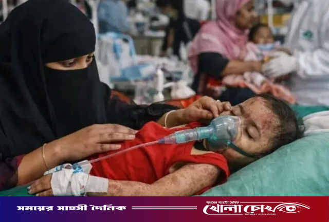 হামের উপসর্গে আরও ১৬ জনের মৃত্যু