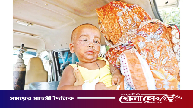 হামের সংক্রমণের মধ্যেই চোখ রাঙাচ্ছে ডিপথেরিয়া। ছড়িয়ে পড়ার শঙ্কা