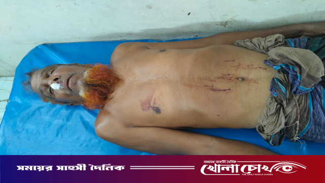 জমি সংক্রান্ত বিরোধে আগৈলঝাড়ায় হামলা, আহত ২