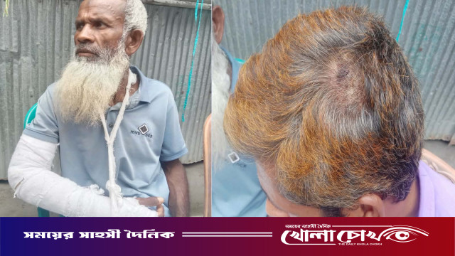 জলঢাকায় পূর্ব শত্রুতার জেরে এক পরিবারের ওপর হামলা, আহত ৫
