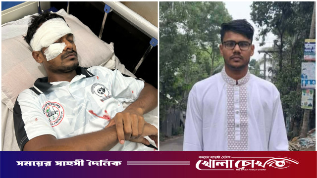 কুবিতে সহপাঠীর হামলায় রক্তাক্ত শিক্ষার্থী, শিকল দিয়ে মারধরের অভিযোগ