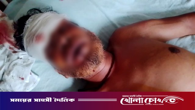 ফরিদপুরের সদরপুরে মাদক ব্যবসায়ীর তাণ্ডব: সৌদি প্রবাসীকে কুপিয়ে জখম, ৩ লাখ টাকা ও মোটরসাইকেল ছিনতাই
