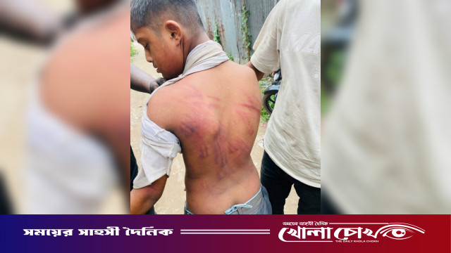 দুটি আমের জন্য মানসিক ভারসাম্যহীন শিশুকে আটকে রেখে রাতভর নির্যাতন