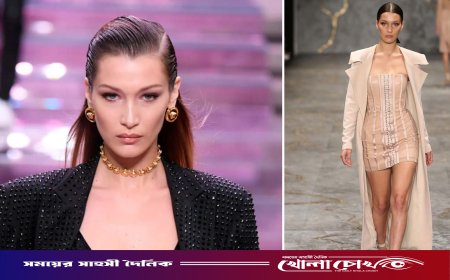 ‘লাইম ডিজিজে’র সঙ্গে লড়াই সুপারমডেল বেলা হাদিদের
