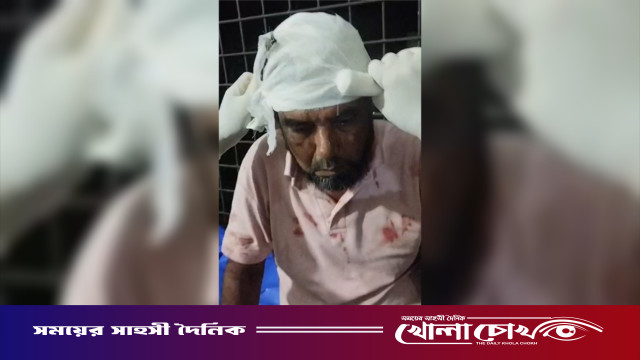 শ্রীনগরে পারিবারিক কলহের জেরে স্বামীর বাড়ীর লোকজনের হামলায় স্ত্রীসহ আহত-৪