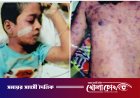 ফরিদপুরে মামা-ভাগিনার রহস্যজনক মৃত্যু: লাশ উত্তোলনের এক বছরেও মেলেনি প্রতিবেদন