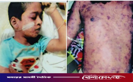 ফরিদপুরে মামা-ভাগিনার রহস্যজনক মৃত্যু: লাশ উত্তোলনের এক বছরেও মেলেনি প্রতিবেদন