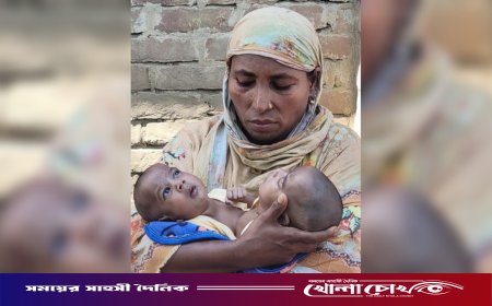 দৌলতপুরে জন্ম নিলো এক দেহে দুই প্রাণের ফুটফুটে জমজ কন্যা সন্তান