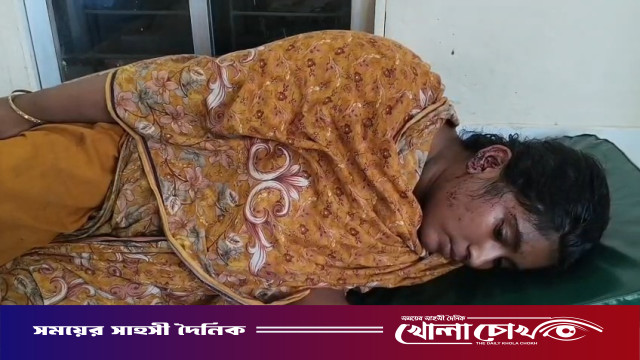 শ্রীনগরে বাড়ীর গেইট থেকে অটোরিকশা সরিয়ে নিতে বলায় চালকের হামলায় ৩ নারীসহ আহত-৪