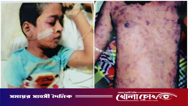 ফরিদপুরে মামা-ভাগিনার রহস্যজনক মৃত্যু: লাশ উত্তোলনের এক বছরেও মেলেনি প্রতিবেদন