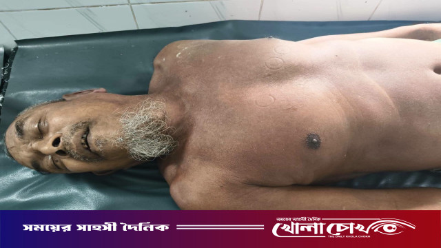 খাগড়াছড়ির মাটিরাঙ্গায় বিদ্যুৎস্পৃষ্ট হয়ে নিহত ১, আহত ২