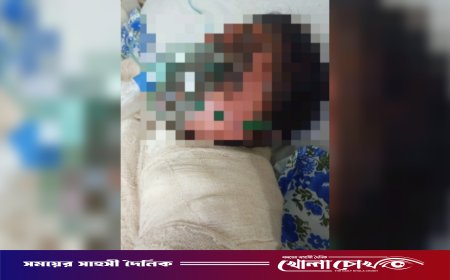 দৌলতপুরে আপত্তিকর ভিডিও ছড়িয়ে দেওয়ার অভিযোগ: গায়ে পেট্রোল ঢেলে নারীর আত্মহত্যার চেষ্টা