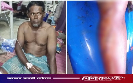দৌলতপুরে পূর্ব বিরোধের জেরে সবজি ব্যবসায়ীর ওপর হামলা, আহত ১