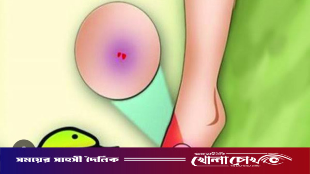 বোয়ালমারীতে বিষধর সাপের কামড়ে ব্যবসায়ীর মৃত্যু, ওঝার ঝাড়ফুঁকে সময় নষ্টের অভিযোগ