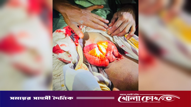 কালকিনিতে শ্বশুরবাড়ির বিরোধ মেটাতে গিয়ে শ্যালকের হামলায় ভগ্নিপতিসহ আহত ৩