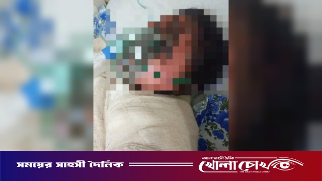 দৌলতপুরে আপত্তিকর ভিডিও ছড়িয়ে দেওয়ার অভিযোগ: গায়ে পেট্রোল ঢেলে নারীর আত্মহত্যার চেষ্টা