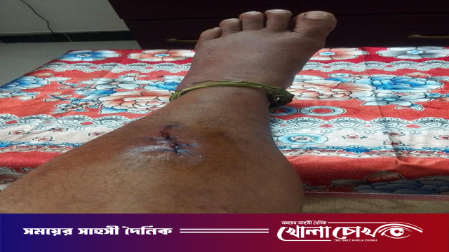 বালিয়াকান্দিতে পূর্ববিরোধের জেরে দফায় দফায় মারপিট ও হত্যাচেষ্টা, থানায় মামলা