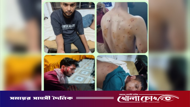নোয়াখালীতে গায়ে হলুদের অনুষ্ঠানে যাওয়ার পথে গুলিবর্ষণ: ক্যামেরাম্যানসহ গুলিবিদ্ধ ৫