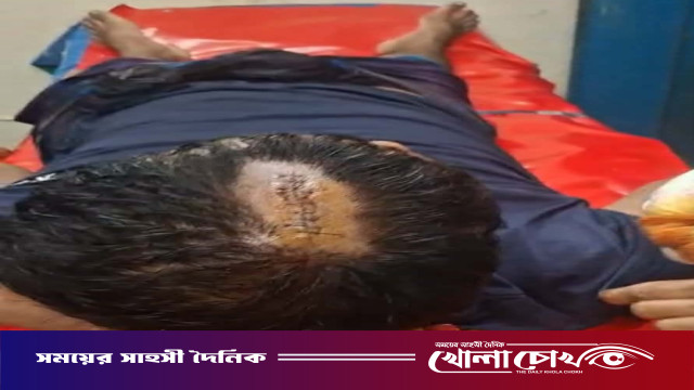 আগৈলঝাড়ায় ঘেরের বিরোধে হামলা: নারীকে মারধর ও স্বর্ণালংকার ছিনতাইয়ের অভিযোগ