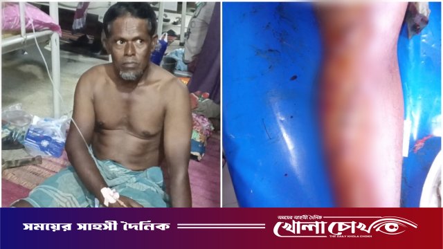 দৌলতপুরে পূর্ব বিরোধের জেরে সবজি ব্যবসায়ীর ওপর হামলা, আহত ১