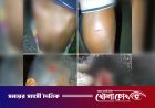 দৌলতপুরে পূর্ব বিরোধের জেরে সংঘর্ষ, নারীসহ আহত ৭