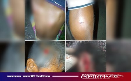 দৌলতপুরে পূর্ব বিরোধের জেরে সংঘর্ষ, নারীসহ আহত ৭