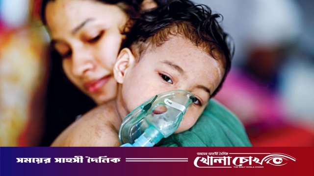 ফরিদপুরে ২৪ ঘণ্টায় নতুন ৪১ জনের হাম শনাক্ত, হাসপাতালে চিকিৎসাধীন ৫৪