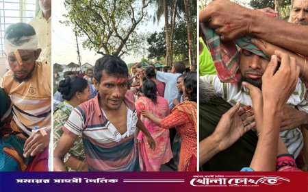 কুষ্টিয়ার দৌলতপুরে পূর্বশত্রুতার জেরে হামলা: দুই ভাইকে কুপিয়ে জখম, টাকা লুট