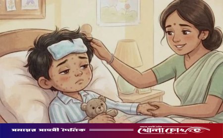 ফরিদপুরে ২৪ ঘণ্টায় আরও ৩৩ জনের হাম শনাক্ত, হাসপাতালে চিকিৎসাধীন ১১০