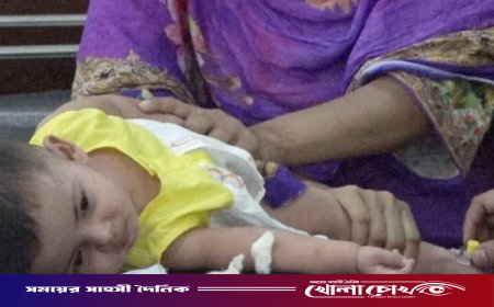 ফরিদপুরে ২৪ ঘণ্টায় ৪২ জনের হাম শনাক্ত, হাসপাতালে ভর্তি ১০৯