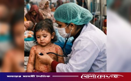 ফরিদপুরে ২৪ ঘণ্টায় হামের সন্দেহভাজন ৩৪ রোগী হাসপাতালে ভর্তি, চিকিৎসাধীন ১২৭