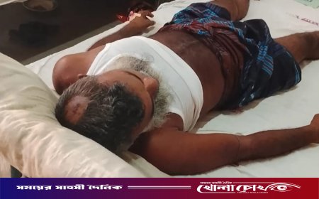 নগরকান্দায় চায়ের দোকানে অতর্কিত হামলা: হাতুড়ি ও ধারালো অস্ত্রের আঘাতে ব্যক্তি গুরুতর আহত