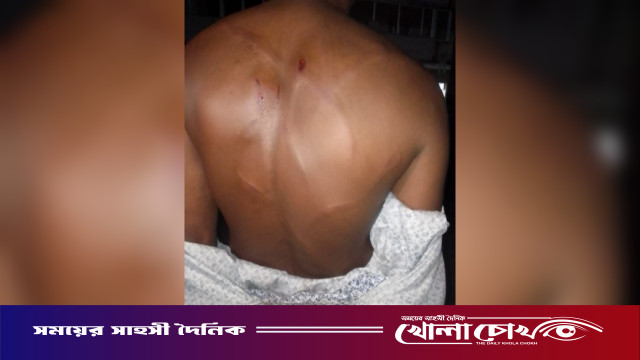 পাওনা টাকা চাওয়ায় সাবেক যুবদল নেতাকে পিটিয়ে আহত করার অভিযোগ বিএনপি নেতার বিরুদ্ধে