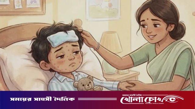 ফরিদপুরে ২৪ ঘণ্টায় আরও ৩৩ জনের হাম শনাক্ত, হাসপাতালে চিকিৎসাধীন ১১০
