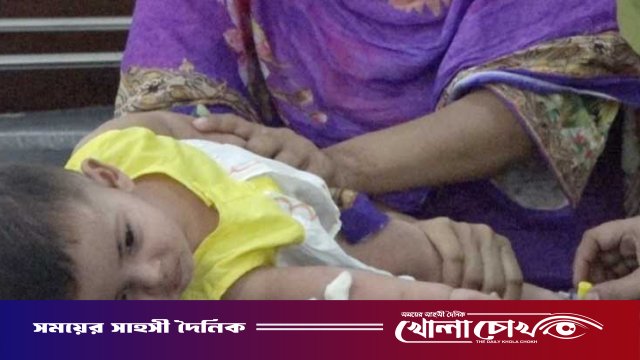 ফরিদপুরে ২৪ ঘণ্টায় ৪২ জনের হাম শনাক্ত, হাসপাতালে ভর্তি ১০৯
